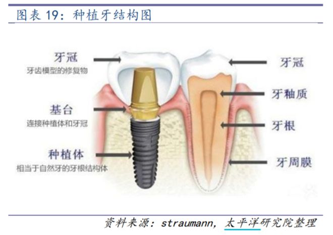 灵魂砍价！这一地种植牙材料最高降幅近90%，千亿市场还有赚头吗？